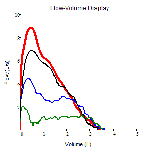 Fig4111FLA